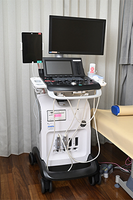 超音波診断装置