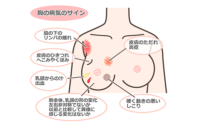 胸の病気のサイン