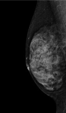 3.不均一高濃度