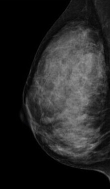 4.極めて高濃度